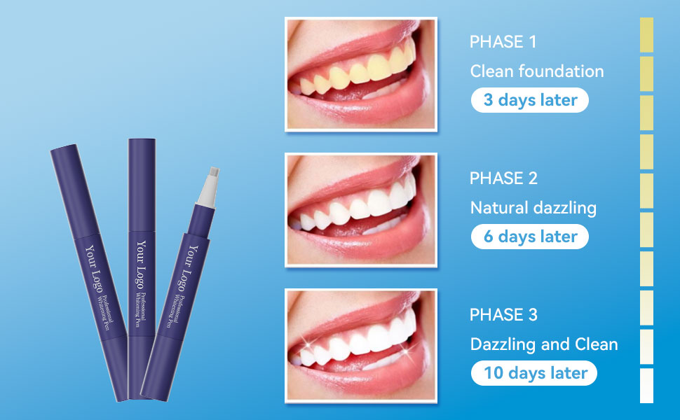 Oral health facts & tips: Teeth whitening